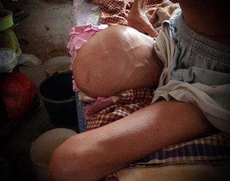 Program Pelayanan Kesehatan